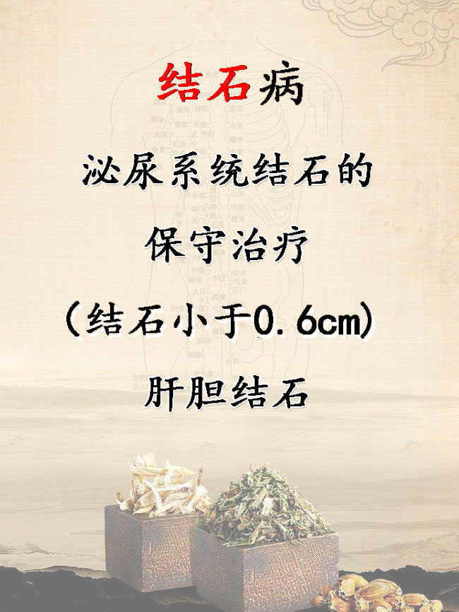 結(jié)石病 結(jié)石病